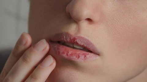 Memahami alasan utama kenapa bibir kering pakai liptint selalu menggumpal di tengah dan terlihat seperti sariawan.